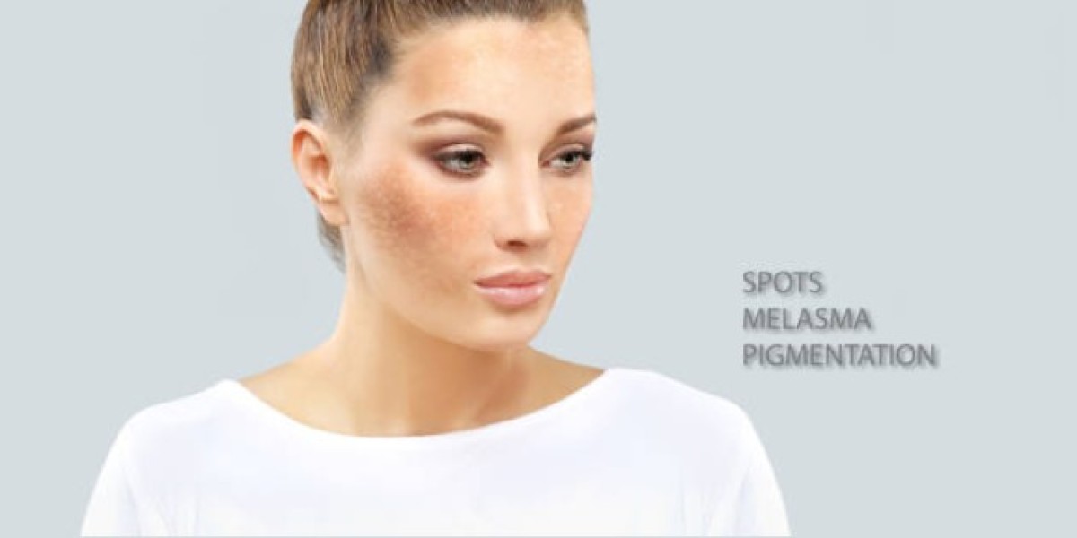 Pigmentation Treatment Near Me: Laser vs Peel Which Is Right for You?