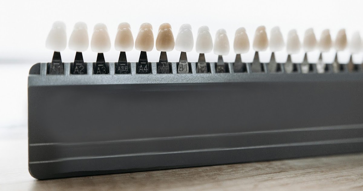 Choosing the Right Path for Smile Repair Options That Last for Years