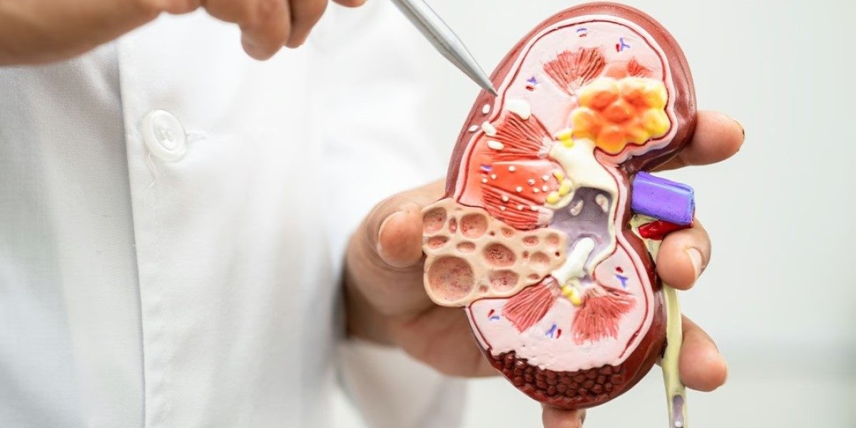 Choosing the Right Care: A Complete Guide to the Best Kidney Transplant Hospital in Bangalore