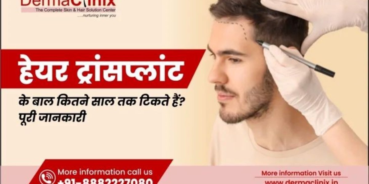 How Long Do Hair Transplant Results Last? | Best Hair Transplant in Delhi – Derma Clinix