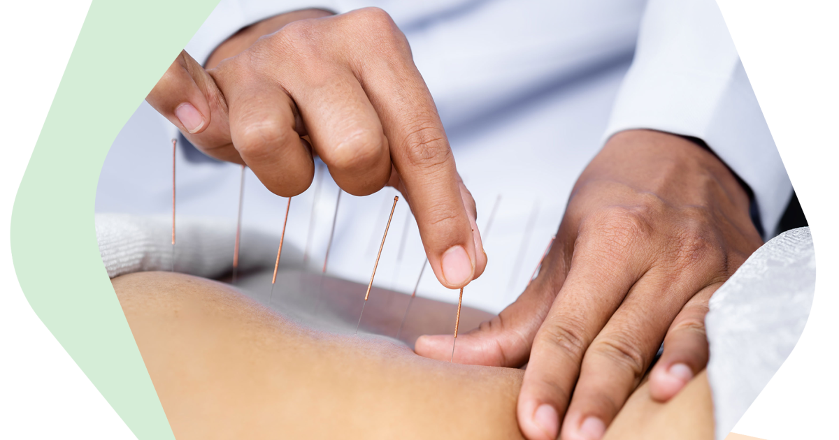 Prominent Facts That Make the Best Calgary Acupuncture Treatments Exceptional