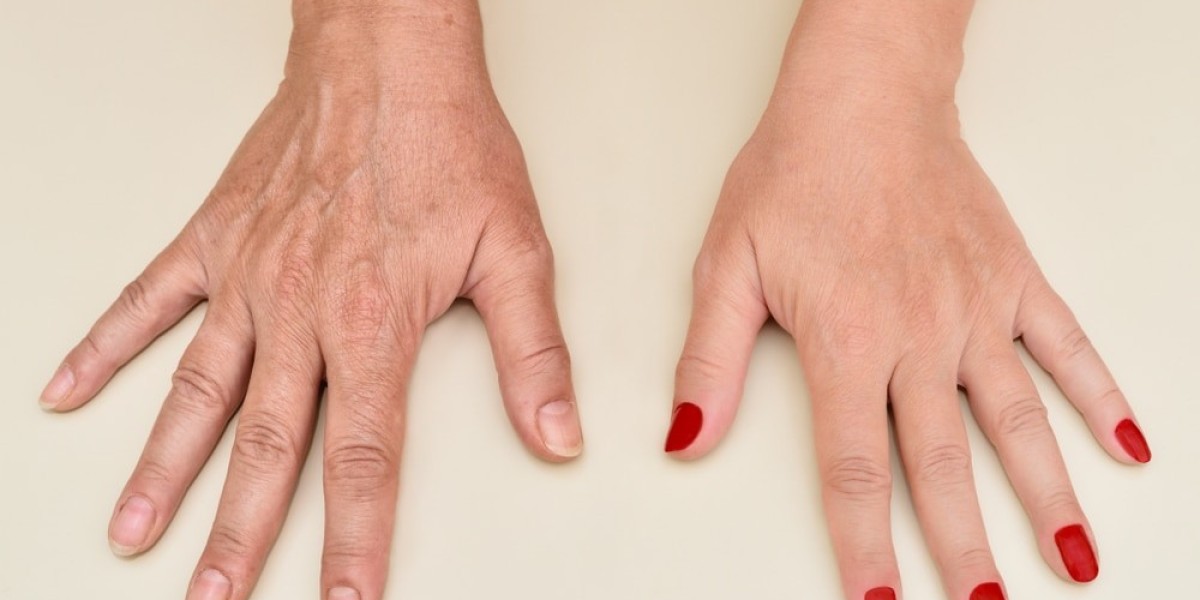 Hands Reborn: Softness, Smoothness, and Radiant Skin: