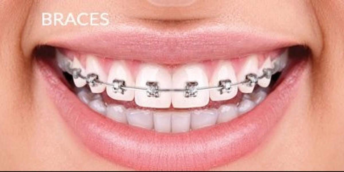 Proven Methods to Discover Trustworthy Clinics That Provide Metal Braces Bahrain