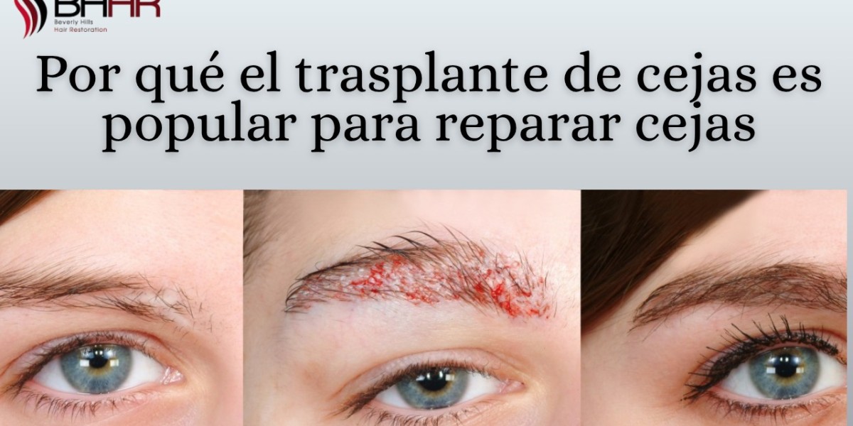 Por qué el trasplante de cejas es popular para reparar cejas