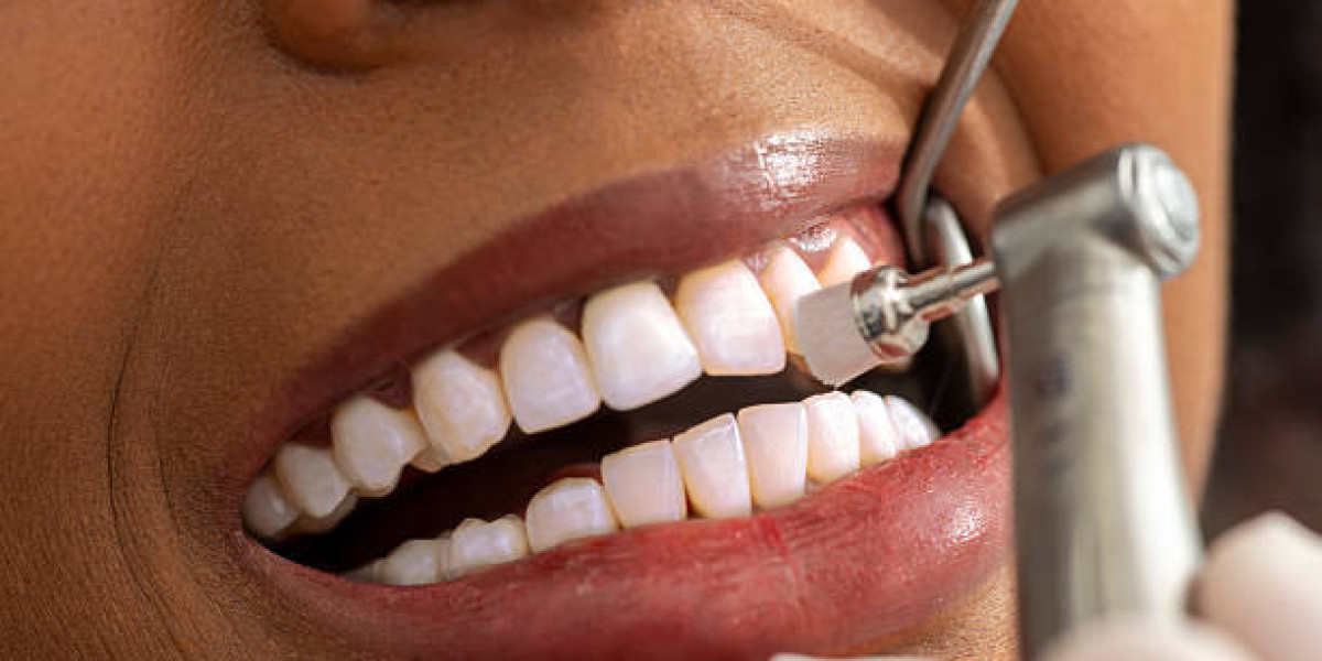 Trusted Dental Clinic in Prabhadevi for Complete Oral Health by Dent Heal